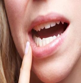 نشانه های زخم دهان چیست؟