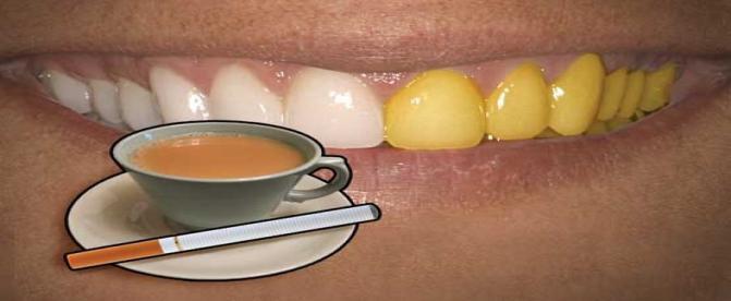 بهداشت دهان و دندان و عوامل موثر در تغییر رنگ دندان