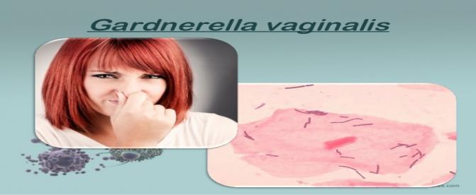 هموفيلوس واژيناليس، عفونت دستگاه تناسلي زنان  (قسمت دوم)