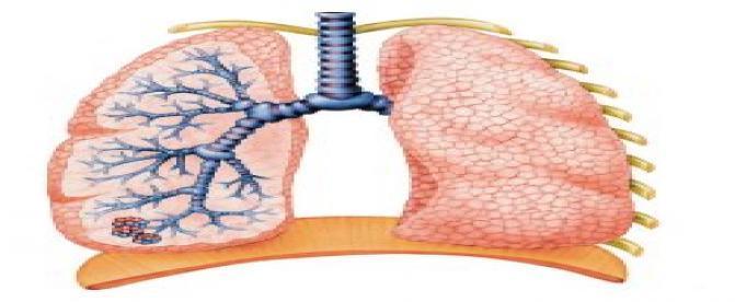 ويروس سن سي شيال تنفسي (RSV) : علائم ، علل و عوامل تشدید کننده