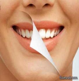 5اصل اساسی برای پیشگیری از پلاک دندانی