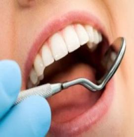 جرم دندانی چیست؟