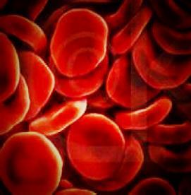 کم خونی همولیتیک خود ایمنی اکتسابی ( AIHA) و نابودی گلبولهای قرمز 